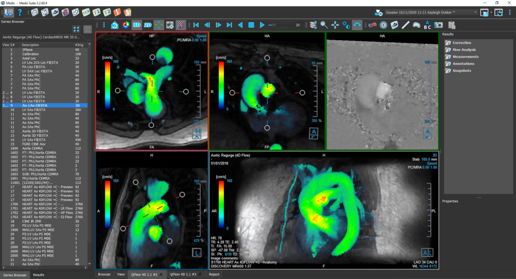 Quad view brain diagnostic image